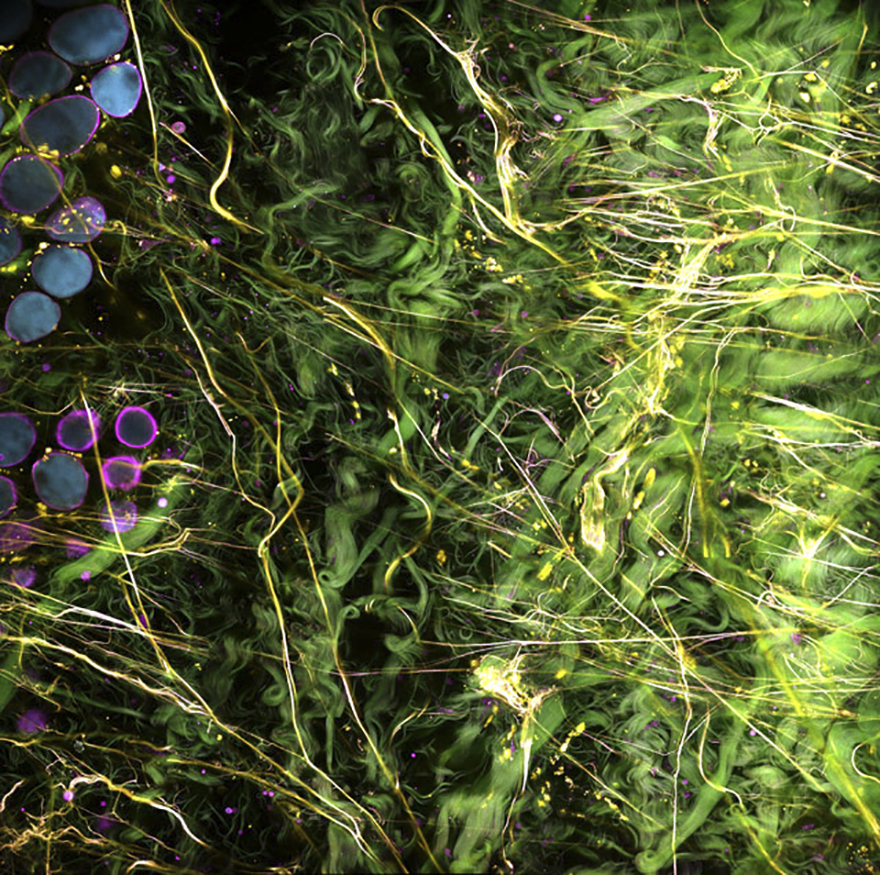 Label-Free Optical Imaging Of Human Breast Tissue, Illinois, Image Of Distinction