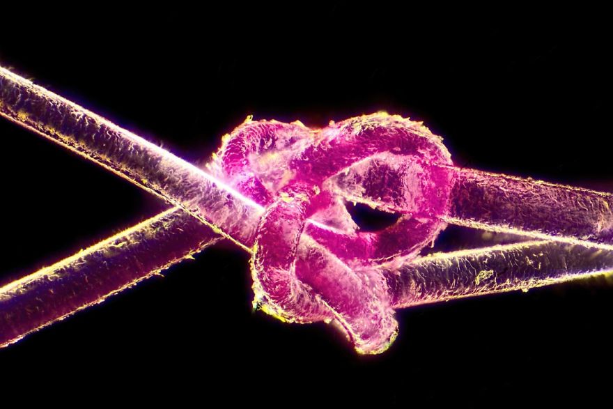 Dyed Human Hair, Steinberg, 17th Place