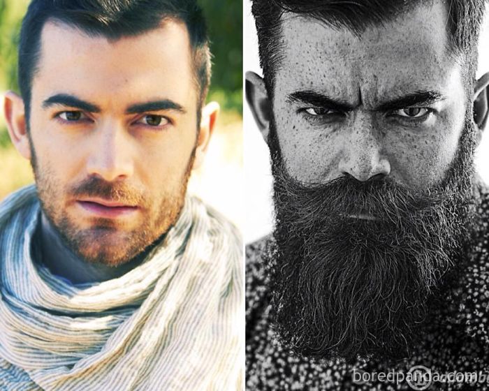 Before After Beard