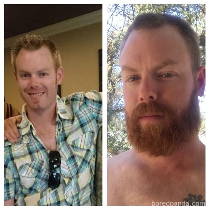 Roughly 3 Months Of Beard Growing