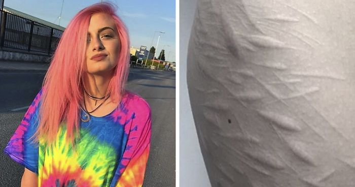 19-Year-Old Wanted To Cover Up Her Self-Harm Scars But All Tattoo Artists Refused To Help. Except One