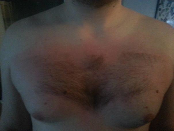 Woke Up Hungover To This