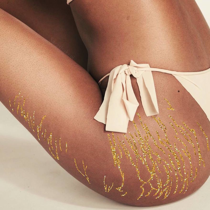 Artist Turns Stretch Marks Into Art In Order To Encourage People To Be Proud Of Them Artist Turns Stretch Marks Into Art In Order To Encourage People To Be Proud Of Them
