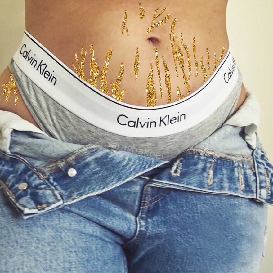Artist Turns Stretch Marks Into Art In Order To Encourage People To Be Proud Of Them Artist Turns Stretch Marks Into Art In Order To Encourage People To Be Proud Of Them