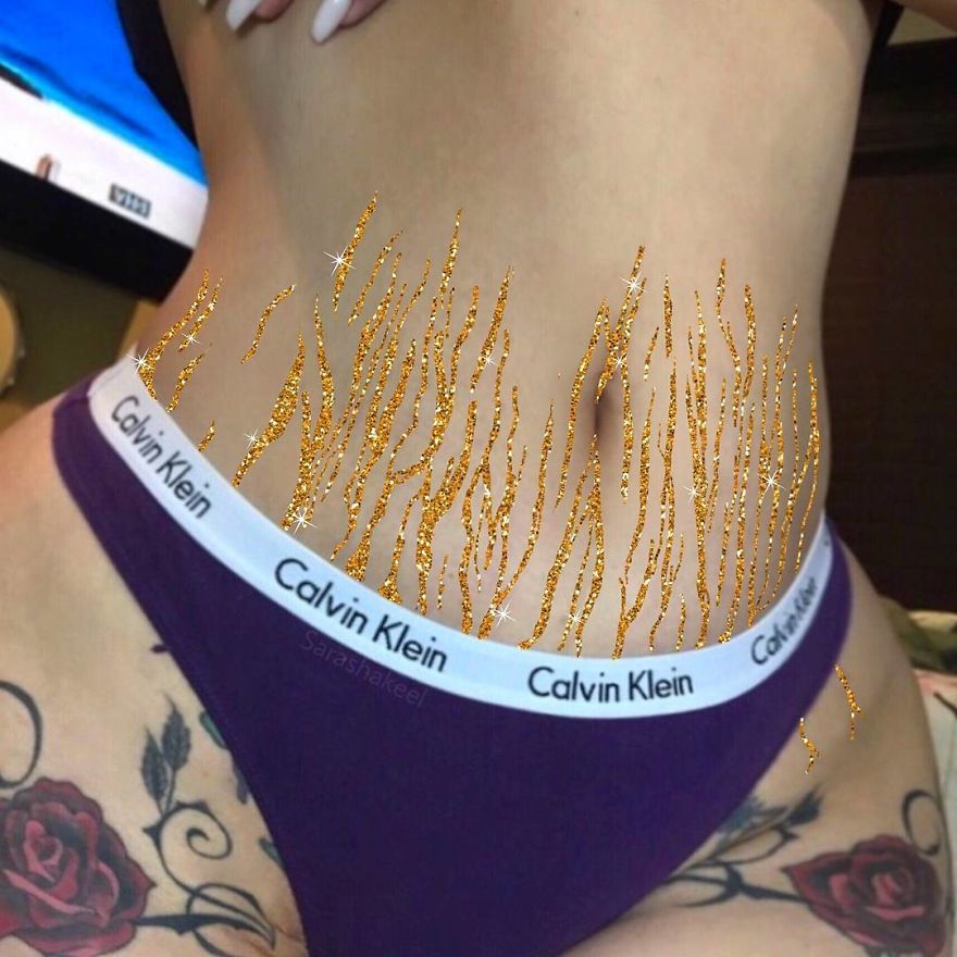 Artist Turns Stretch Marks Into Art In Order To Encourage People To Be Proud Of Them Artist Turns Stretch Marks Into Art In Order To Encourage People To Be Proud Of Them