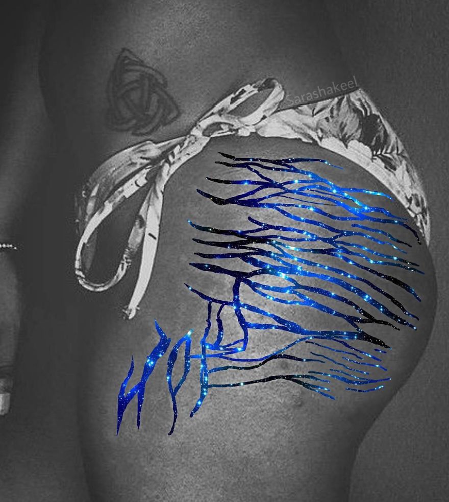 Artist Turns Stretch Marks Into Art In Order To Encourage People To Be Proud Of Them