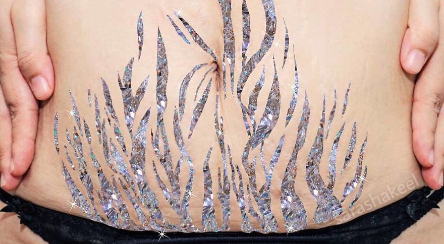 Artist Turns Stretch Marks Into Art In Order To Encourage People To Be Proud Of Them Artist Turns Stretch Marks Into Art In Order To Encourage People To Be Proud Of Them