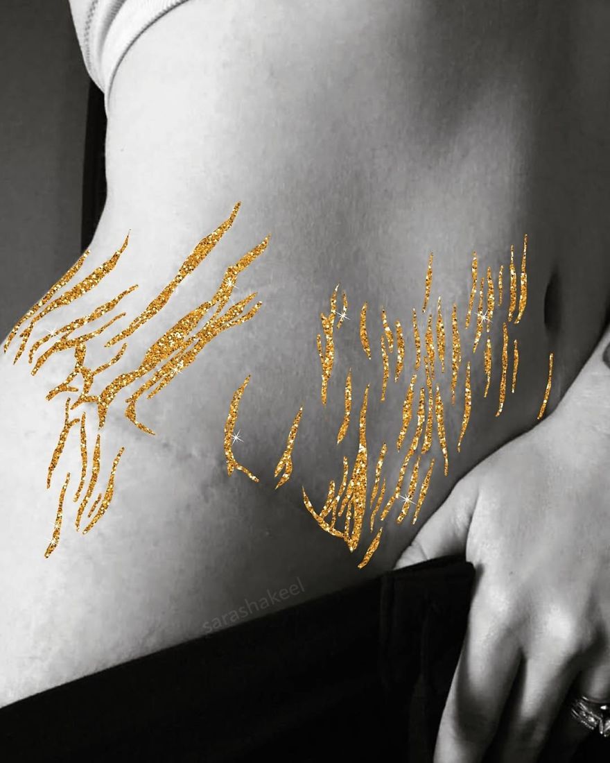 Artist Turns Stretch Marks Into Art In Order To Encourage People To Be Proud Of Them