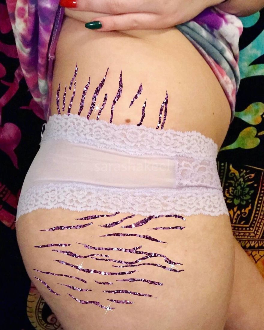 Artist Turns Stretch Marks Into Art In Order To Encourage People To Be Proud Of Them