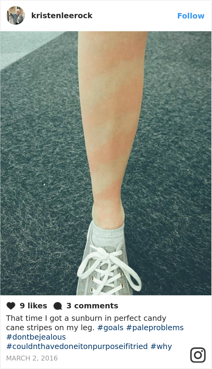 Funny-Pale-People-Problems