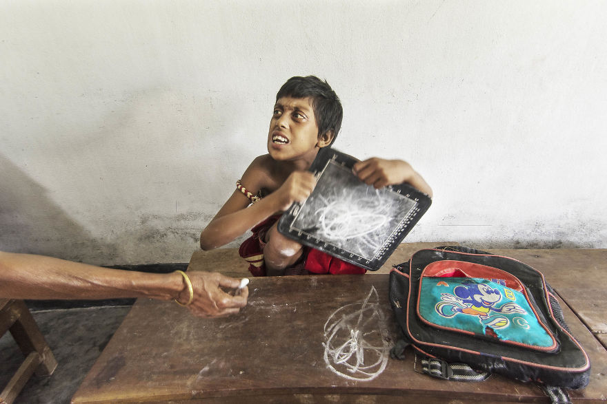 The Success Story Of A Special Child