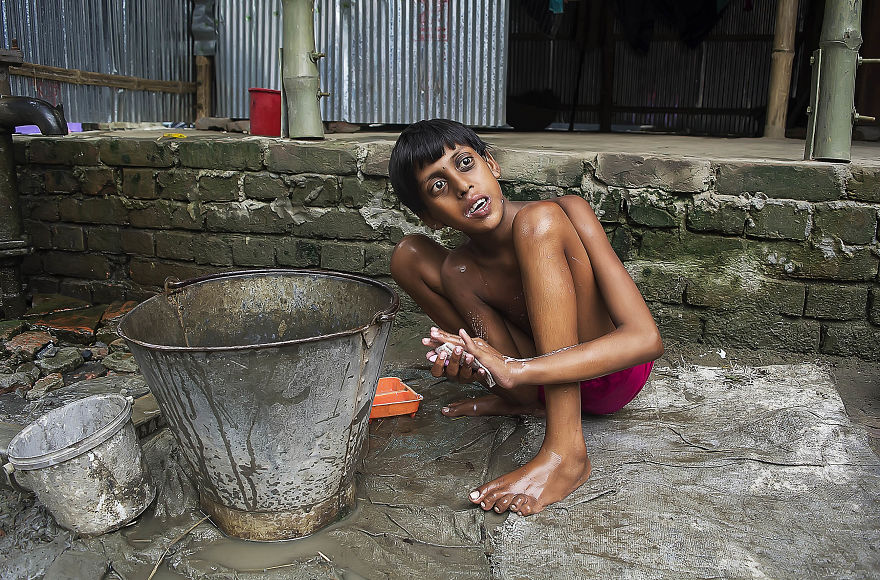 The Success Story Of A Special Child The Success Story Of A Special Child