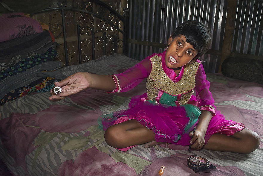 The Success Story Of A Special Child