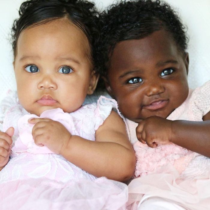 Girls Born In Different Colors Make It Nearly Impossible To Tell They Are Twins Girls Born In Different Colors Make It Nearly Impossible To Tell They Are Twins