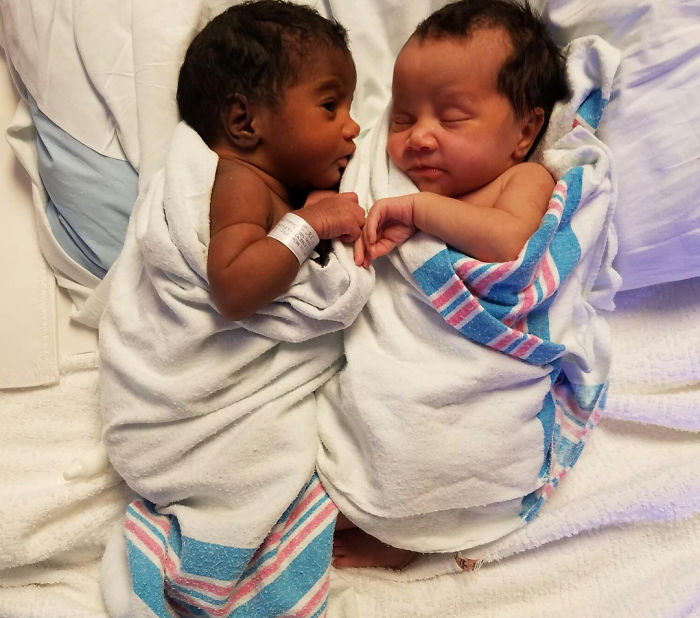 Girls Born In Different Colors Make It Nearly Impossible To Tell They Are Twins Girls Born In Different Colors Make It Nearly Impossible To Tell They Are Twins