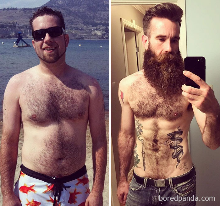 Before And After Beard