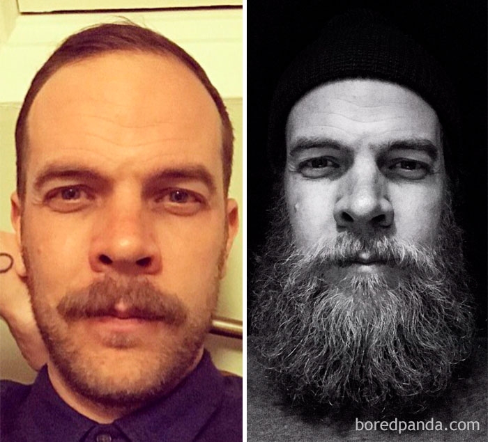 About 6 Months Now Between These Two Photos