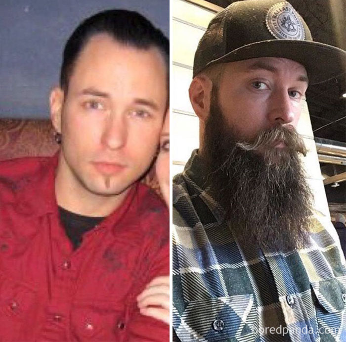 Before And After Beard