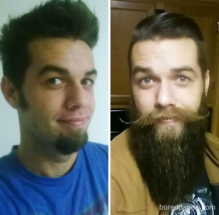 Before And After Beard