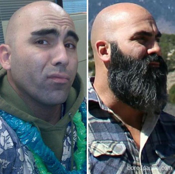 Before And After Growing A Beard