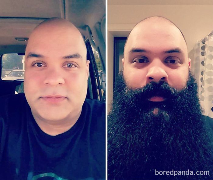 Before And After Beard