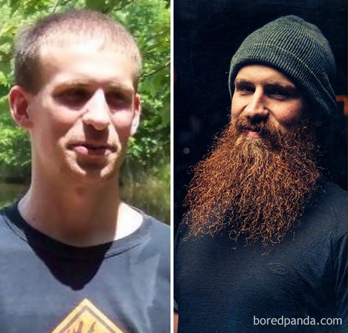 Before And After Beard