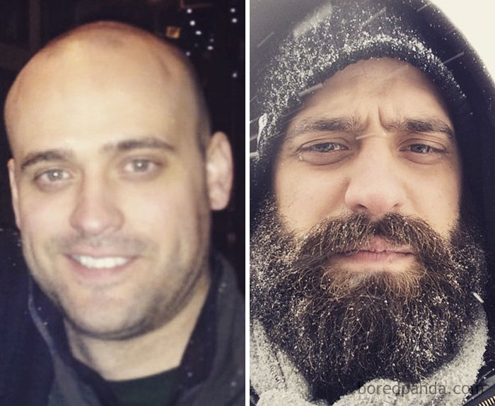 Beard Transformation