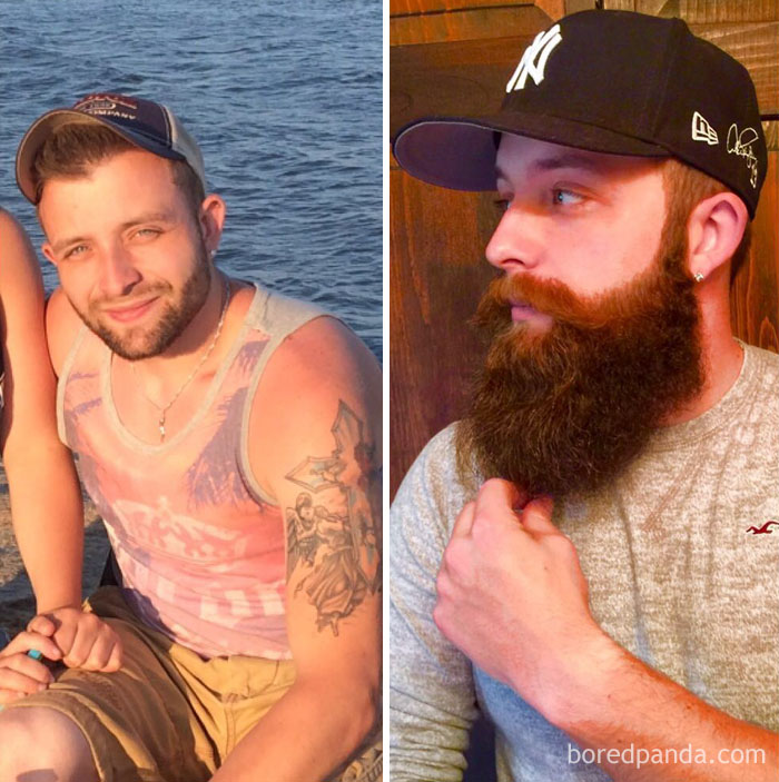 Before And After Beard