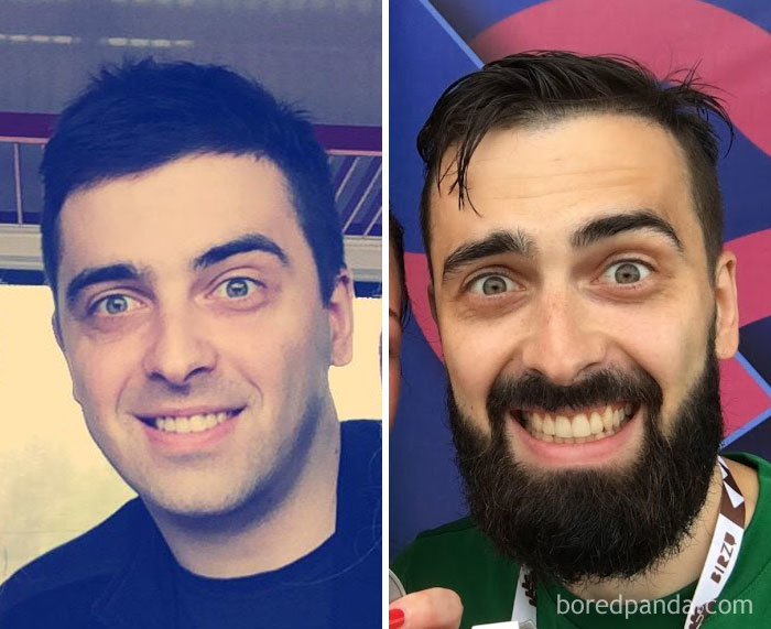 Before And After Growing A Beard