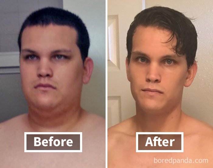 Before and after face fat loss in a weight loss journey, showing significant changes.