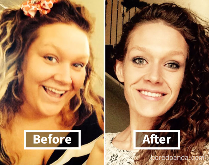 Face fat loss transformation with before and after weight loss photos of a smiling woman.
