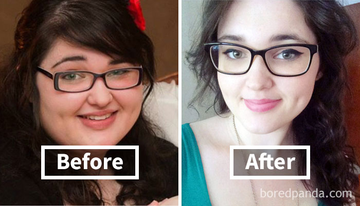 Face fat loss before and after weight loss transformation with glasses.
