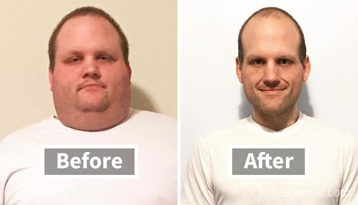 Face fat loss shown in before and after weight loss photo, with noticeable changes in appearance.