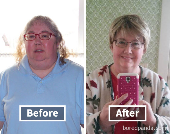 Before and after face fat loss image showing the impact of weight loss.
