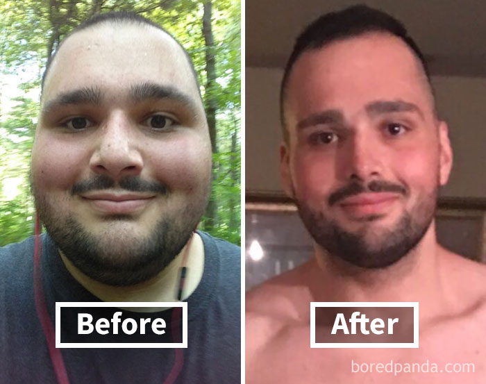 Before and after photo showing a man's face fat loss due to weight loss.