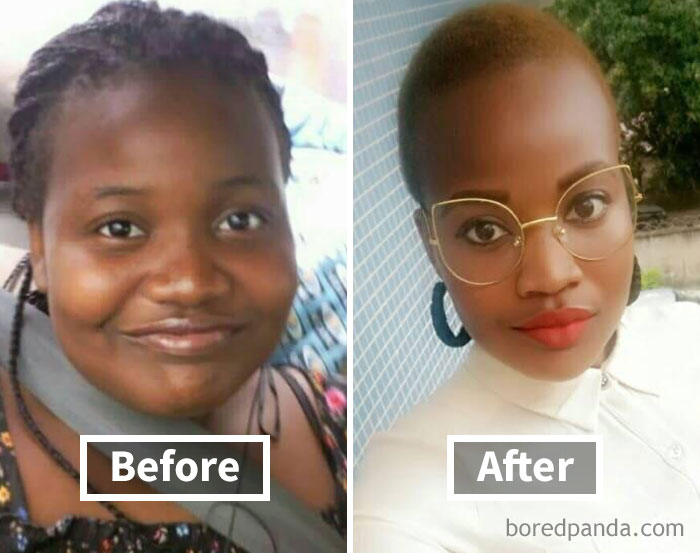 Before and after photo showing face fat loss transformation and weight loss progress.