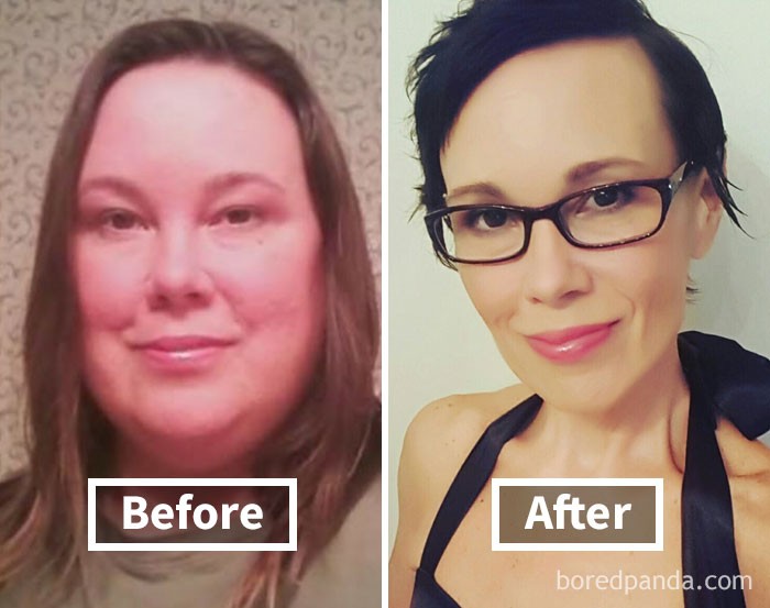 Before and after photos showing face fat loss after weight loss, featuring noticeable transformation.