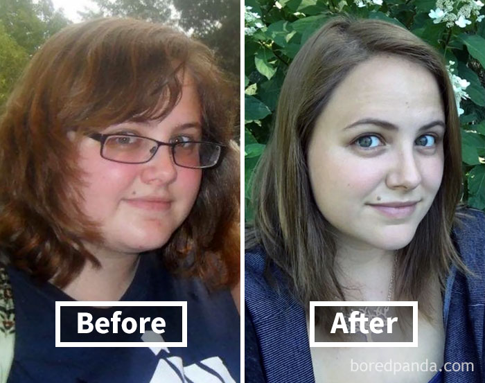 Face fat loss transformation with noticeable changes in before and after photos.
