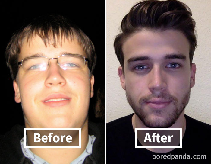 Before and after face fat loss comparison, showing significant changes in appearance.