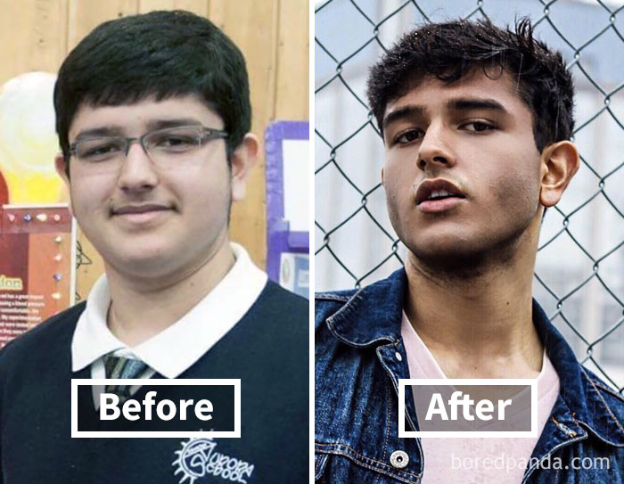 Before and after face fat loss transformation, highlighting weight loss effects.