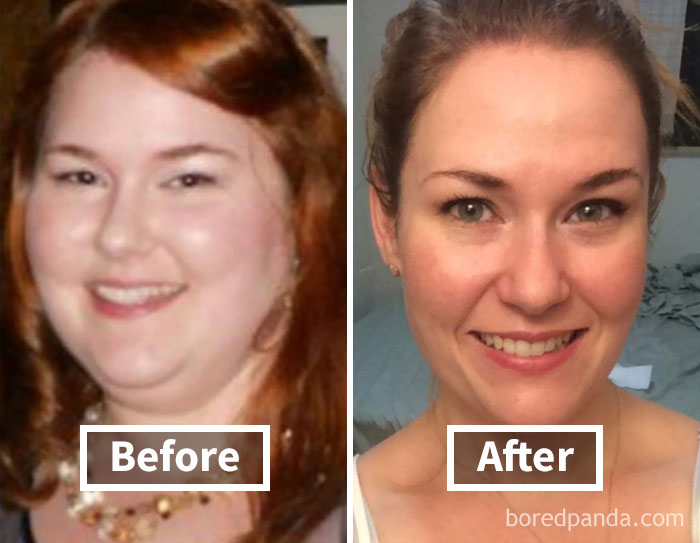 Before and after photos showing face fat loss and weight loss transformation.