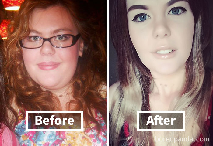 Face fat loss before and after weight loss transformation, showcasing a noticeable difference in facial features.