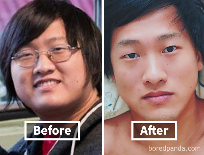 Face fat loss before and after weight loss; comparison of two images side by side.