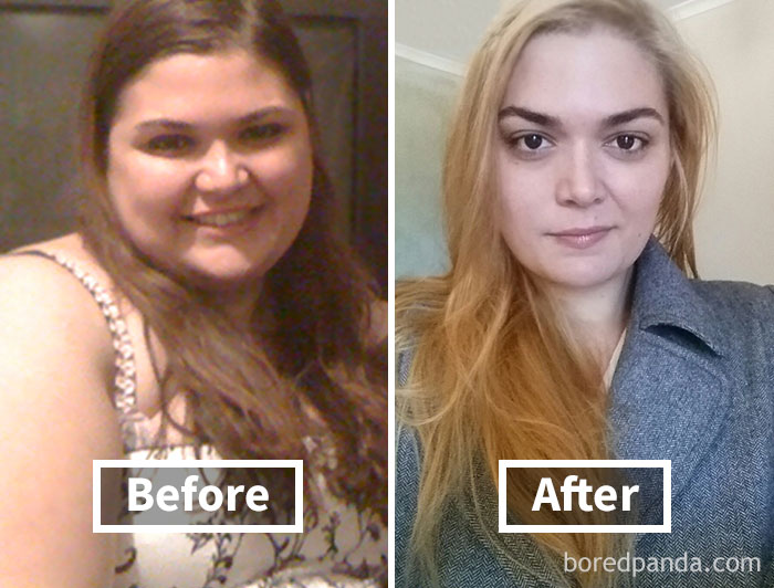 Side-by-side comparison of face fat loss before and after weight loss, highlighting significant transformation.