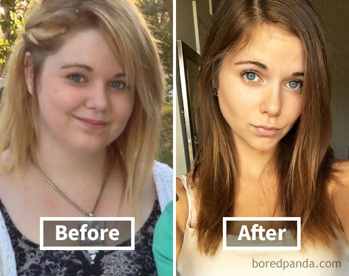 Before and after photos showing face fat loss and weight loss transformation in a woman.