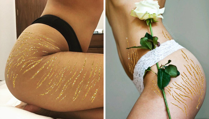 Artist Turns Stretch Marks Into Art In Order To Encourage People To Be Proud Of Them