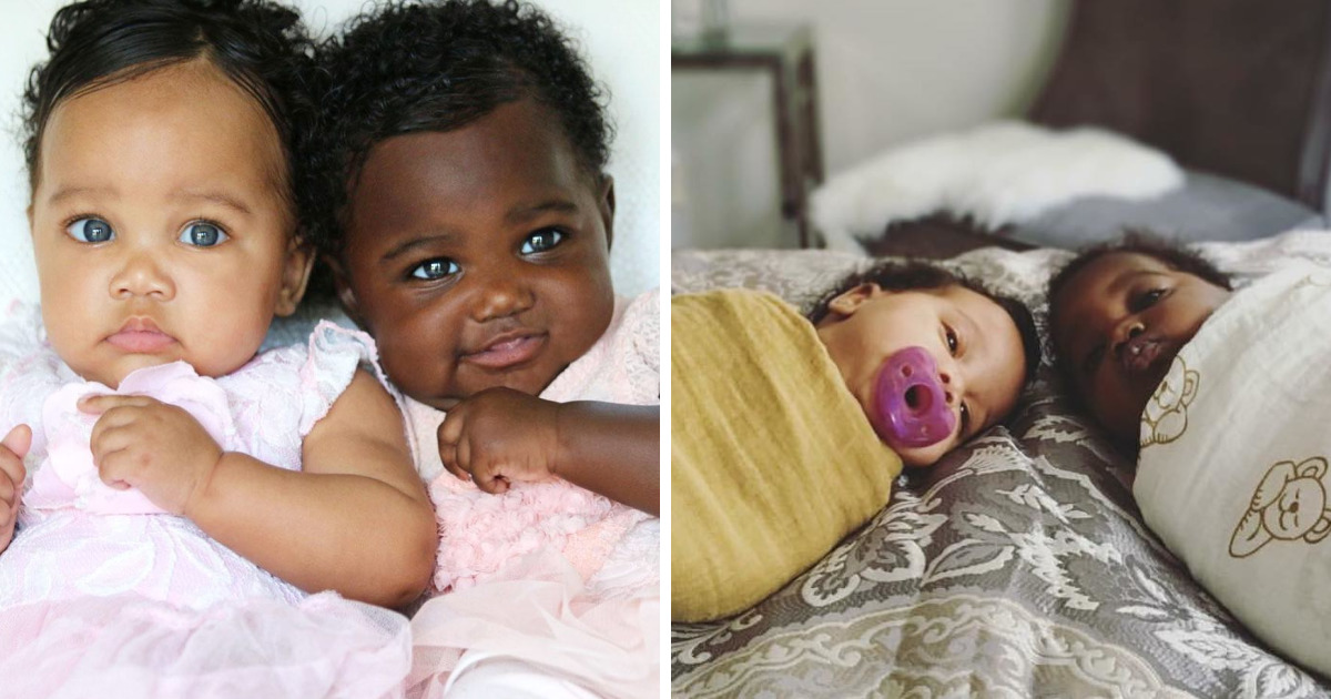 Twins Born With Different Color Skintones Win Over Our Hearts, Proving Ever...