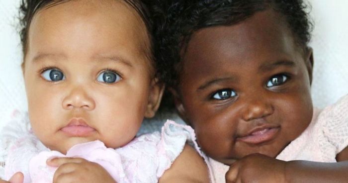 Girls Born In Different Colors Make It Nearly Impossible To Tell They Are TwinsGirls Born In Different Colors Make It Nearly Impossible To Tell They Are Twins