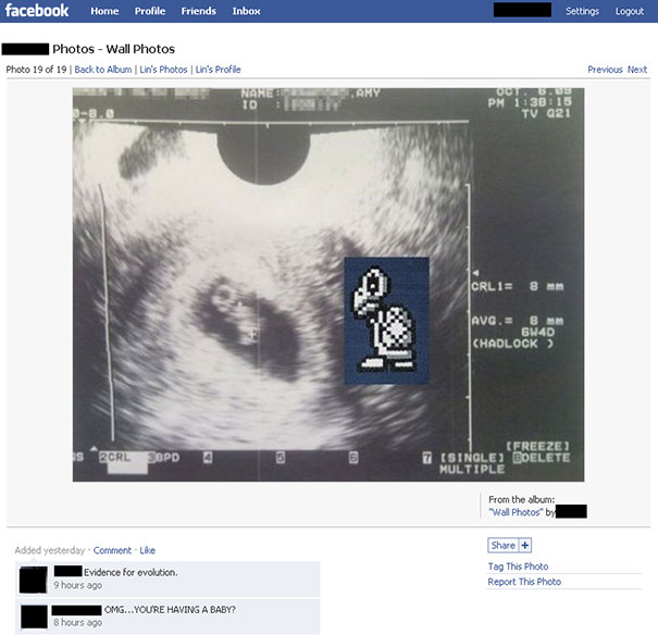 Here Is What The Husband Did With The Sonogram