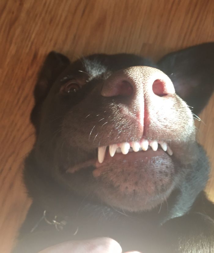 River Has A Severe Overbite, With A 1-Inch Gap Between His Top And Bottom Teeth.